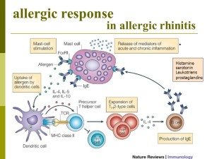 seasonal allergy headaches